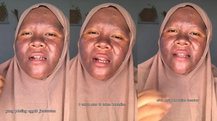 Bahaya Merkuri pada Skincare, Dampak dan Cara Menghindarinya